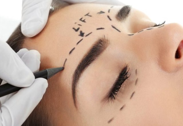 Ideal Candidate for Brow Lift Surgery